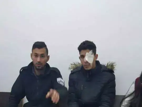 עלאא סלאח, תושב מזרח ירושלים שנורה ואיבד את עינו (צילום מסך , טוויטר)