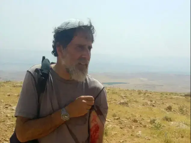 פעילי שמאל שליוו רועי צאן פלסטינים בבנימין הותקפו בידי מתנחלים, 21 באפריל 2017 (מערכת וואלה! NEWS , שרית מיכאלי, בצלם)