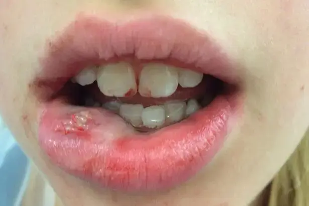 פנים הושחתו בגלל אפליקציית פנס באייפון (צילום מסך)