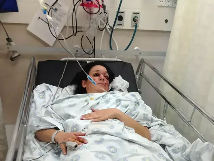 עדי בן מנחם, נפצעה בתאונת הדרכים בנשר, אפריל 2013 (שלומי גבאי) עדי בן מנחם, נפצעה בתאונת הדרכים בנשר, אפריל 2013 (שלומי גבאי)