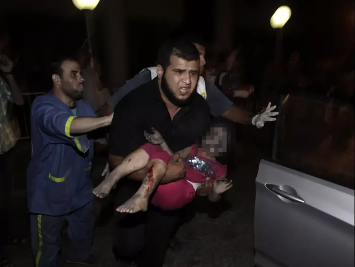 פצועים מתקיפת צה"ל ברצועת עזה (AP) פצועים מתקיפת צה"ל ברצועת עזה (AP)