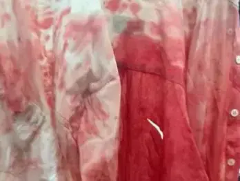 תלמיד ישיבה שנפצע באורח בינוני מדקירות במהלך תקיפת ערבים במזרח ירושלים בחודש נובמבר (יח"צ) תלמיד ישיבה שנפצע באורח בינוני מדקירות במהלך תקיפת ערבים במזרח ירושלים בחודש נובמבר (יח"צ)
