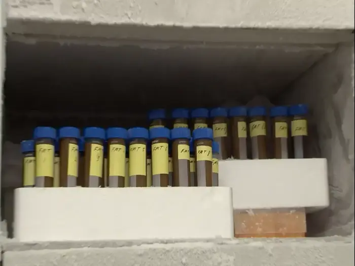 בנק צואה באיכילוב (יח"צ , ליאור צור) בנק צואה באיכילוב (יח"צ , ליאור צור)