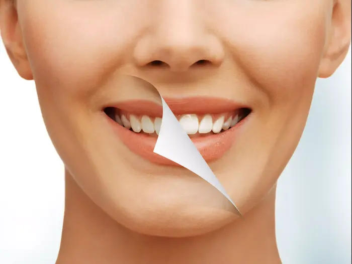 חיוך עם שיניים לבנות (ShutterStock) חיוך עם שיניים לבנות (ShutterStock)