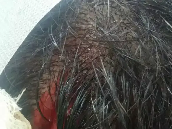 שוטר שהותקף בכפר ג'אסר אזרקא ע"י שני צעירים לאחר שביקש מהתושבים לשמור על השקט, מאי 2015 (חטיבת דובר המשטרה) שוטר שהותקף בכפר ג'אסר אזרקא ע"י שני צעירים לאחר שביקש מהתושבים לשמור על השקט, מאי 2015 (חטיבת דובר המשטרה)
