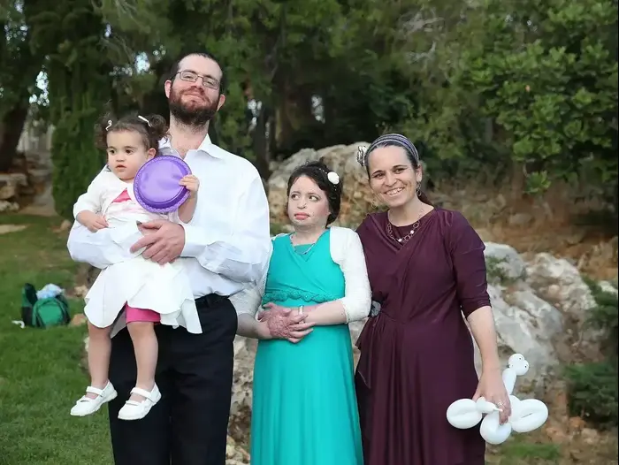 איילה שפירא חוגגת בת מצווה לאחר שנפגעה מבקבוק תבערה, יוני 2015 (יח"צ , דוברות מועצה אזורית שומרון) איילה שפירא חוגגת בת מצווה לאחר שנפגעה מבקבוק תבערה, יוני 2015 (יח"צ , דוברות מועצה אזורית שומרון)