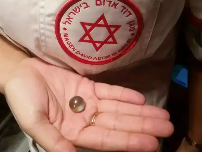 גולה שבלע ונחנק ממנה תינוק בן 11 חודשים, בני ברק, 17 בנובמבר 2015 (מד"א) גולה שבלע ונחנק ממנה תינוק בן 11 חודשים, בני ברק, 17 בנובמבר 2015 (מד"א)
