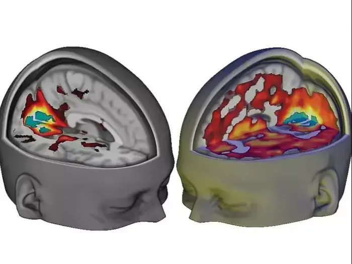 השפעת LSD על המוח (צילום מסך) השפעת LSD על המוח (צילום מסך)