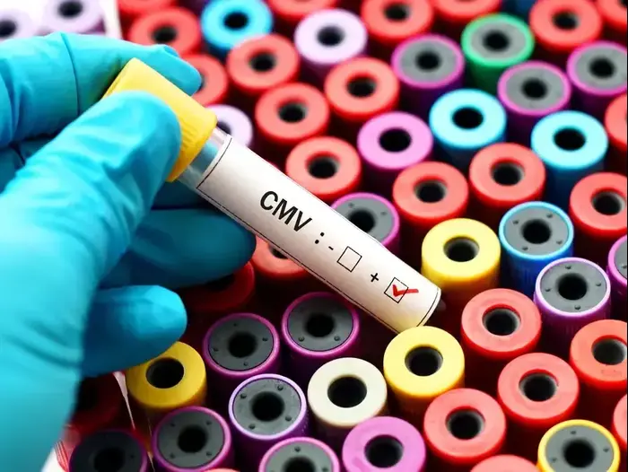 נגיף CMV (ShutterStock) נגיף CMV (ShutterStock)
