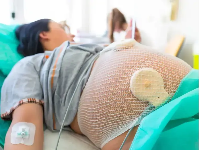 אישה בהריון מחוברת למוניטור עוברי (ShutterStock) אישה בהריון מחוברת למוניטור עוברי (ShutterStock)