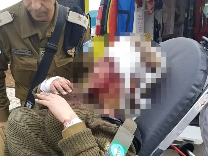 שני חיילים נפצעו קל לאחר שרכב צבאי נכנס בשוגג לג'נין, 12 בפברואר 2018 (מערכת וואלה! NEWS , ללא קרדיט) שני חיילים נפצעו קל לאחר שרכב צבאי נכנס בשוגג לג'נין, 12 בפברואר 2018 (מערכת וואלה! NEWS , ללא קרדיט)