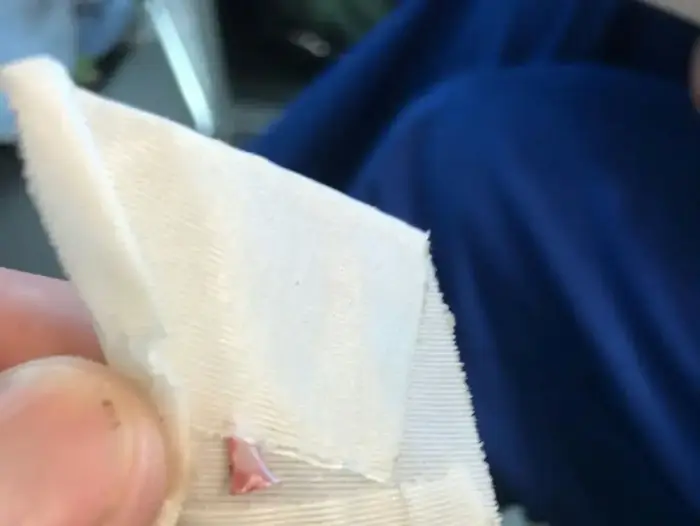 שן של כריש שהוצאה מרגלו של נער שהותקף בניו יורק, 19 ביולי 2018 (רויטרס) שן של כריש שהוצאה מרגלו של נער שהותקף בניו יורק, 19 ביולי 2018 (רויטרס)