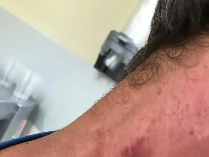 ניק פנקס ממושב ברמת הגולן שטוען כי הרביצו לו לאחר שהעיר למתארחים בצימר לא לקטוף מהמטע שלו, ספטמבר 2019 (באדיבות המצולמים) ניק פנקס ממושב ברמת הגולן שטוען כי הרביצו לו לאחר שהעיר למתארחים בצימר לא לקטוף מהמטע שלו, ספטמבר 2019 (באדיבות המצולמים)
