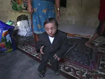קאגנדרה תפה מאגר, האיש הנמוך ביותר בעולם (AP , Altaf Qadri) קאגנדרה תפה מאגר, האיש הנמוך ביותר בעולם (AP , Altaf Qadri)
