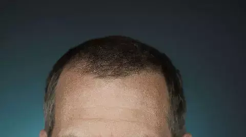 יו לורי בתפקיד האוס (יח"צ)