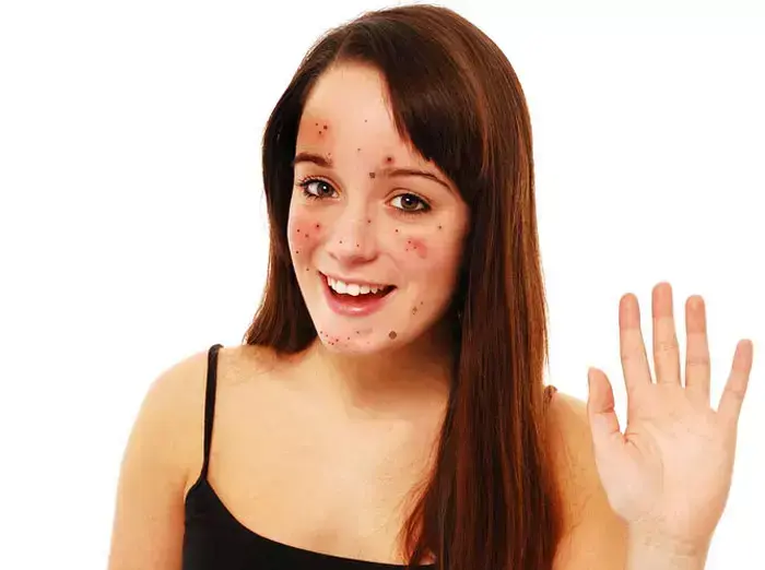 אילוסטרציה (ShutterStock) אילוסטרציה (ShutterStock)