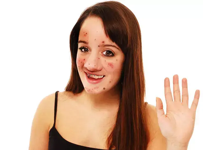 אילוסטרציה (ShutterStock) אילוסטרציה (ShutterStock)