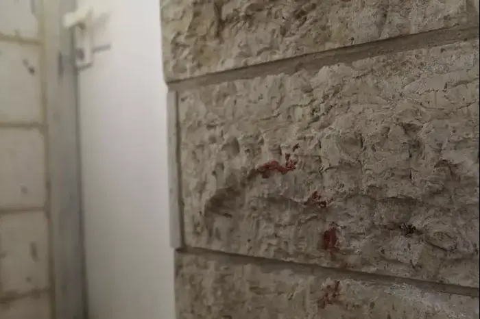 גבר דקר למוות את חברתו לשעבר וניסה להתאבד באמצעות שתיית חומר ניקוי בירושלים (טלי מאייר ) גבר דקר למוות את חברתו לשעבר וניסה להתאבד באמצעות שתיית חומר ניקוי בירושלים (טלי מאייר )