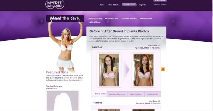 קהילות פטיש באינטרנט: הגדלת חזה (אתר רשמי , http://myfreeimplants.com) קהילות פטיש באינטרנט: הגדלת חזה (אתר רשמי , http://myfreeimplants.com)