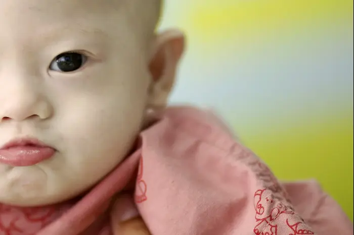 התינוק גאמי שהושאר אצל אמו הפונדקאית בגלל תסמונת הדאון שלו. תאילנד, אוגוסט 2014 (רויטרס) התינוק גאמי שהושאר אצל אמו הפונדקאית בגלל תסמונת הדאון שלו. תאילנד, אוגוסט 2014 (רויטרס)