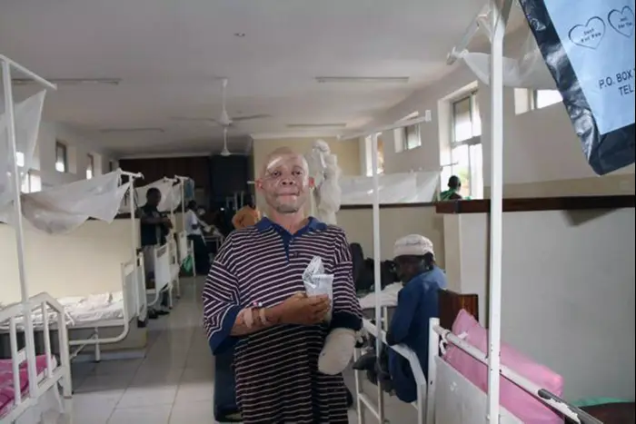 לבקנים סובלים מרדיפה בטנזניה (AP) לבקנים סובלים מרדיפה בטנזניה (AP)