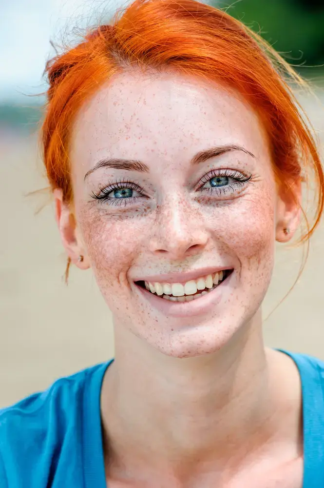 אישה ג'ינג'ית מנומשת מחייכת (ShutterStock) אישה ג'ינג'ית מנומשת מחייכת (ShutterStock)