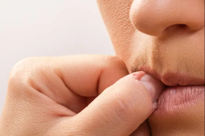 כסיסת ציפורניים (ShutterStock) כסיסת ציפורניים (ShutterStock)