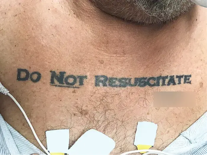 קעקוע "לא לערוך החייאה" (אתר רשמי , New England Journal of Medicine) קעקוע "לא לערוך החייאה" (אתר רשמי , New England Journal of Medicine)