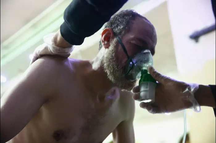 אדם שנפגע במתקפה של המשטר הסורי באזור דמשק מטופל בבית חולים, 26 בפברואר 2018 (רויטרס) אדם שנפגע במתקפה של המשטר הסורי באזור דמשק מטופל בבית חולים, 26 בפברואר 2018 (רויטרס)