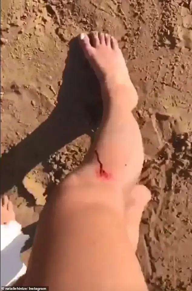 סלפי שלא הצליח (צילום מסך) סלפי שלא הצליח (צילום מסך)
