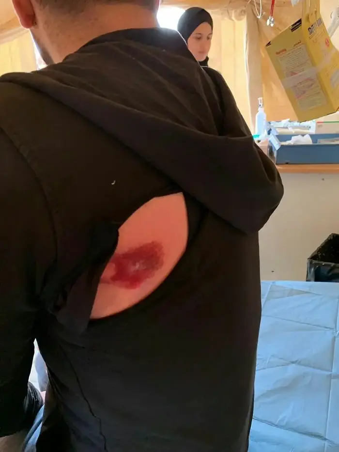 עיתונאי פלסטיני נפצע מרימון גז בגבול עזה, 1 פברואר 2019 (אתר רשמי) עיתונאי פלסטיני נפצע מרימון גז בגבול עזה, 1 פברואר 2019 (אתר רשמי)