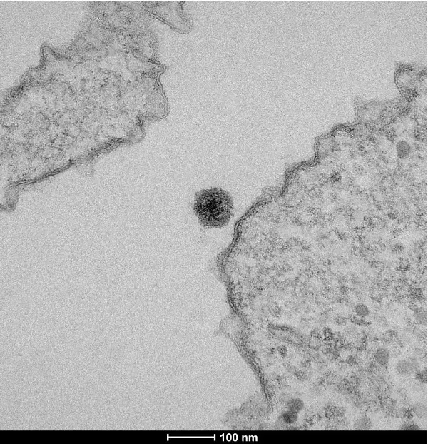 וירוס Yaravirus (צילום מסך , Aix Marseille University and Microscopy Center) וירוס Yaravirus (צילום מסך , Aix Marseille University and Microscopy Center)