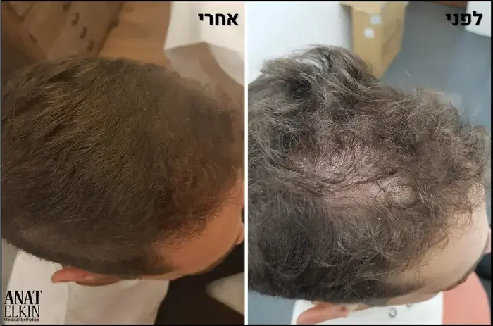 הייר סולושן (יח"צ) הייר סולושן (יח"צ)