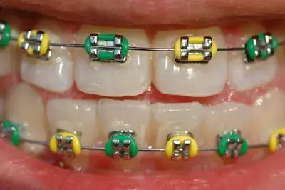 בית הספר לרפואת שיניים ימשיך להתקיים
