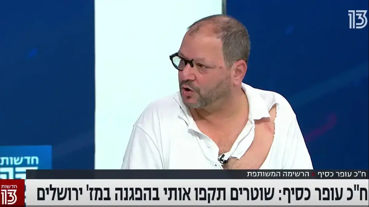 ×'×—×•×œ×¦×