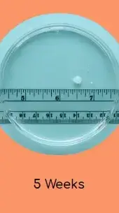 הריון שבוע 5 https://myanetwork.org/the-issue-of-tissue/ הריון שבוע 5 https://myanetwork.org/the-issue-of-tissue/