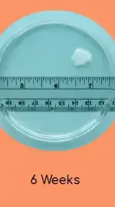 הריון שבוע 6 https://myanetwork.org/the-issue-of-tissue/ הריון שבוע 6 https://myanetwork.org/the-issue-of-tissue/