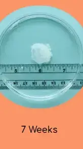 הריון שבוע 7 https://myanetwork.org/the-issue-of-tissue/ הריון שבוע 7 https://myanetwork.org/the-issue-of-tissue/