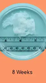 הריון שבוע 8 https://myanetwork.org/the-issue-of-tissue/ הריון שבוע 8 https://myanetwork.org/the-issue-of-tissue/