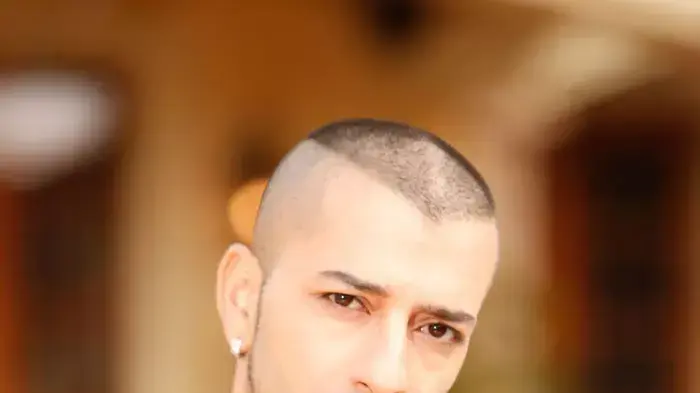 אלון דה לוקו אלון דה לוקו