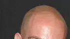 אלון פוטרמן