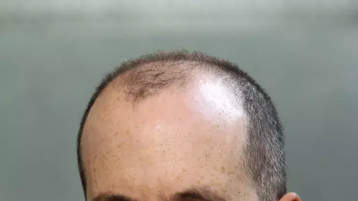 אלדד קובלנץ 
