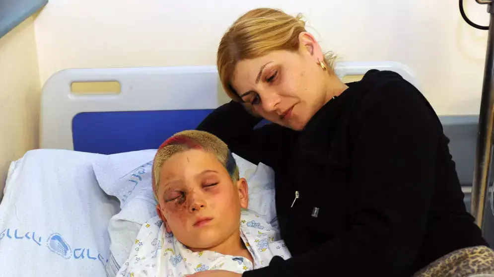 מירב ורון מוריאטי, שנפצע בעינו מנפץ 