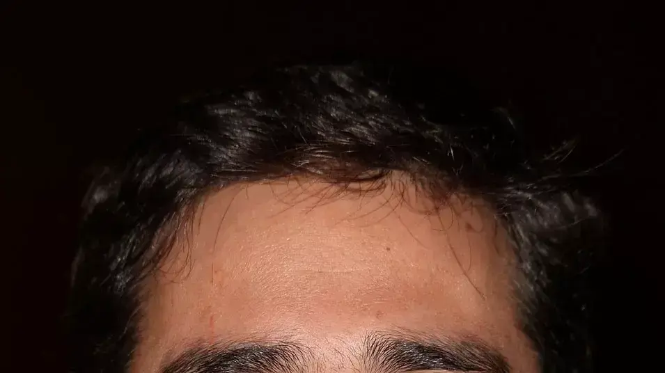 אוליבייה נקש אוליבייה נקש