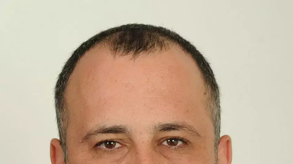 חיליק בר