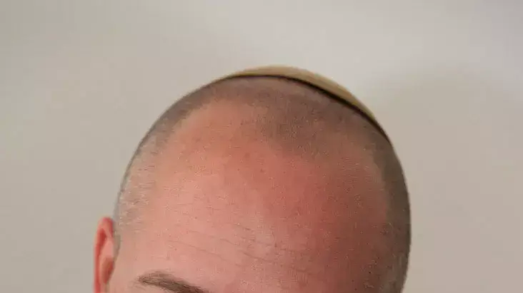 שופטי בג"ץ דנו הבוקר בעתירתו של אל"מ ארז וינר נגד מבקר המדינה, יוני 2012 שופטי בג"ץ דנו הבוקר בעתירתו של אל"מ ארז וינר נגד מבקר המדינה, יוני 2012
