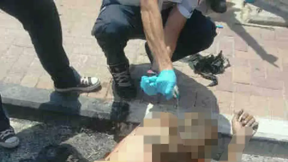נכה הצית עצמו בתחנת אוטובוס - מצבו קשה נכה הצית עצמו בתחנת אוטובוס - מצבו קשה