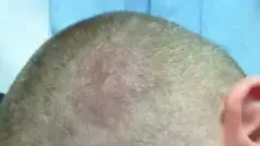 ר', שהוכה על פי החשד על ידי בלשי משטרת גבעתיים ר', שהוכה על פי החשד על ידי בלשי משטרת גבעתיים