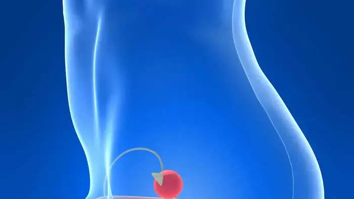 אילוסטרציה אילוסטרציה