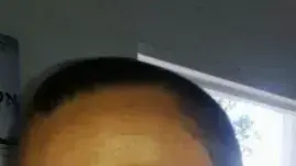 חייל בפיקוד צפון הותקף באכזריות בבסיס צה"ל חייל בפיקוד צפון הותקף באכזריות בבסיס צה"ל